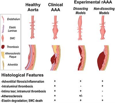 Progress in murine models of ruptured abdominal aortic aneurysm